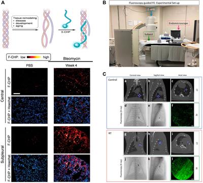 Recent Advances in Fluorescence Imaging of Pulmonary Fibrosis in Animal Models